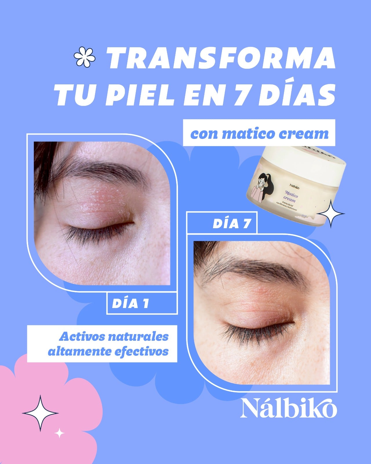 Resultados en la piel de la crema de matico calmante y regeneradora de Nálbiko